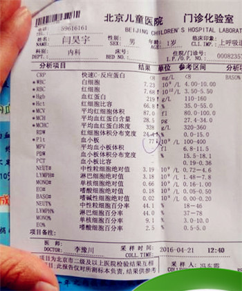 血小板低的原因，血小板低是什么原因引起的？图1
